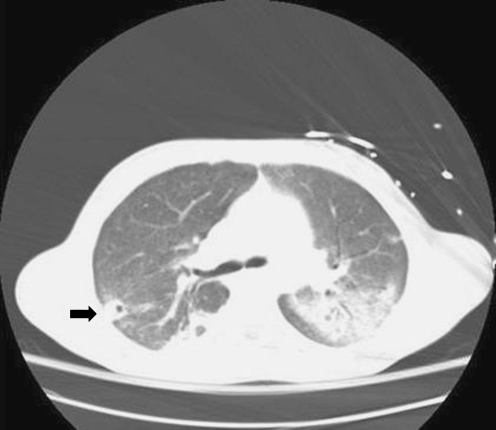 Fig. 6