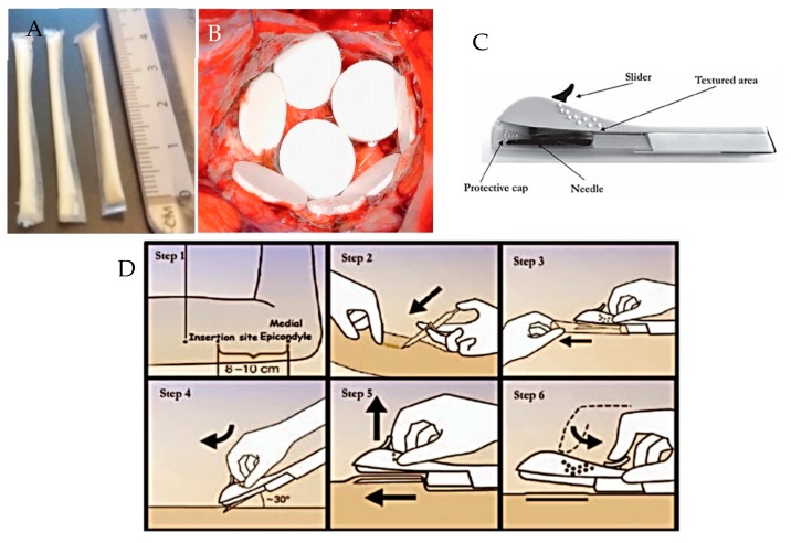 Figure 11