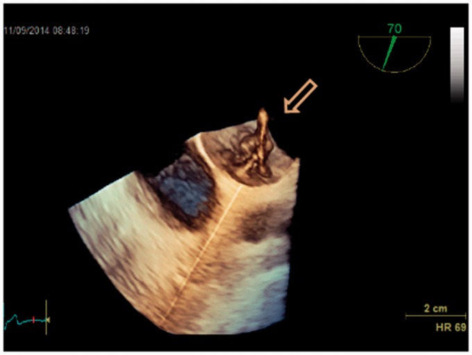 Fig. 3.