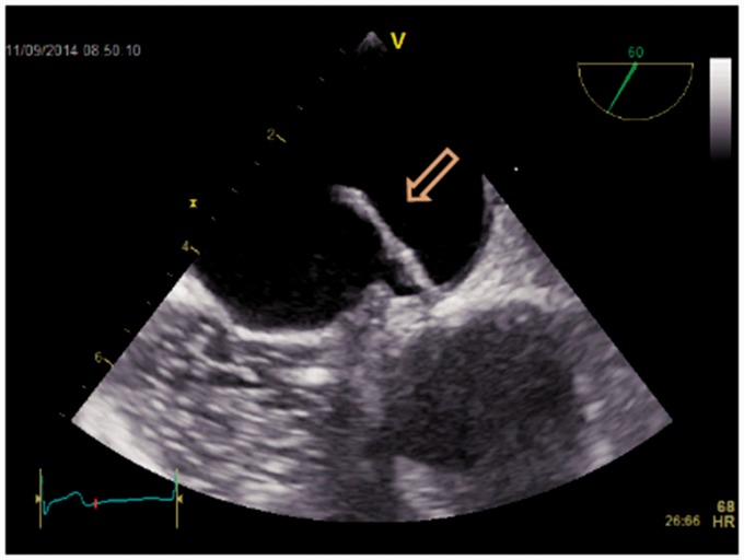 Fig. 5.