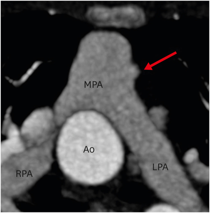 Figure 19