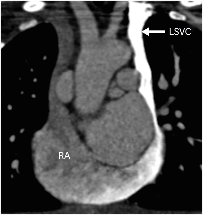 Figure 20