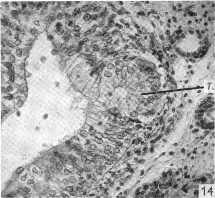 Fig. 14