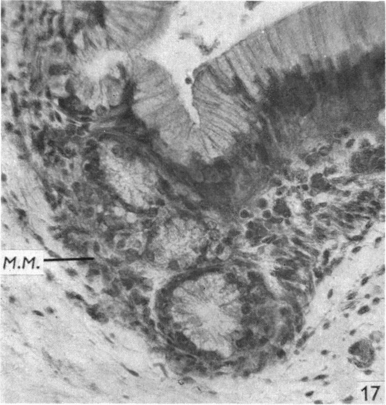 Fig. 17