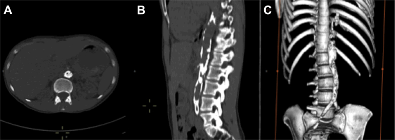 Fig 2