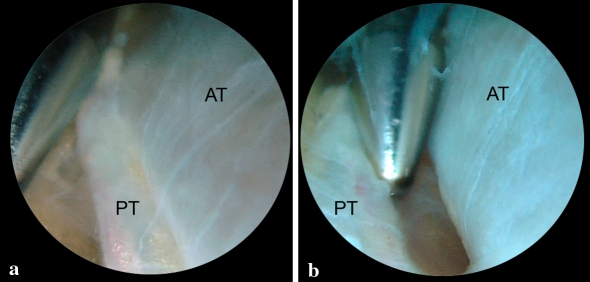 Fig. 4