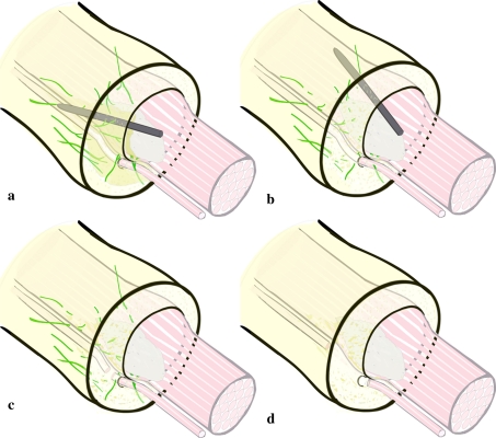 Fig. 5