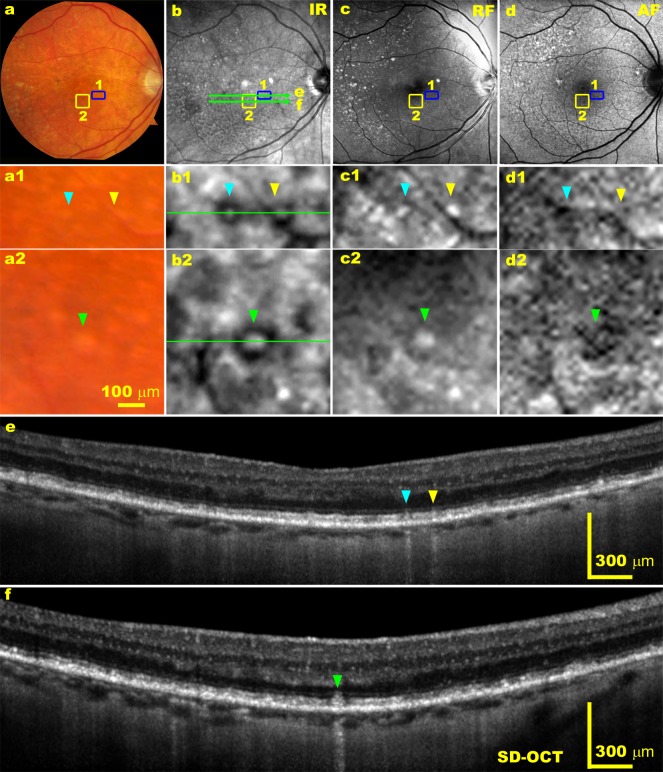 Fig. 4