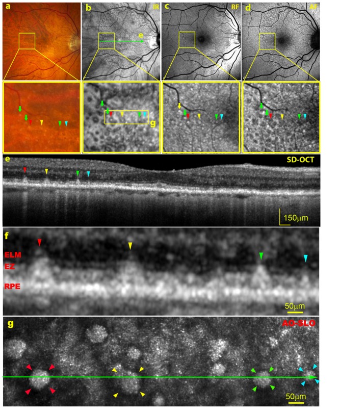 Fig. 3