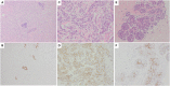 Figure 21