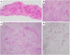 Figure 23
