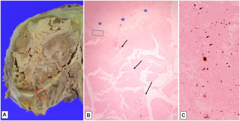 Figure 9