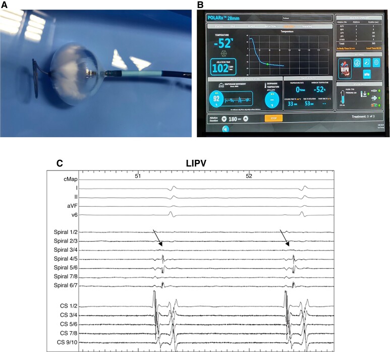 Figure 1