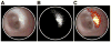 Fig. 3