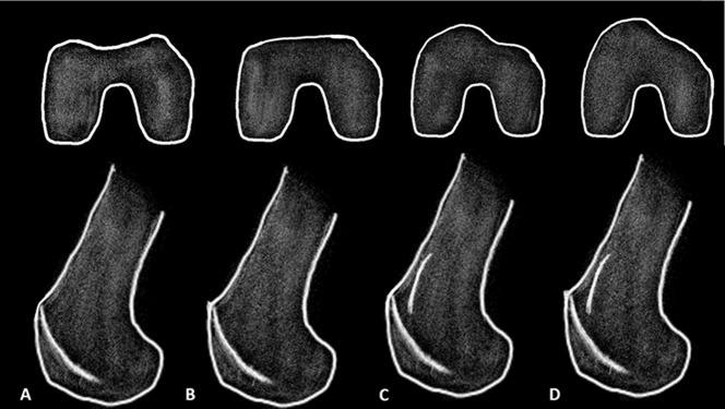 Fig. 4 A-D