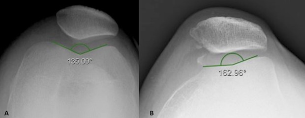 Fig. 5 A-B