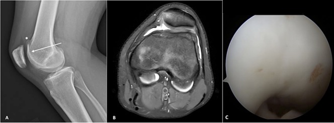 Fig. 3 A-C