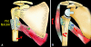Fig. 2A–B