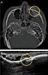 Fig. 2