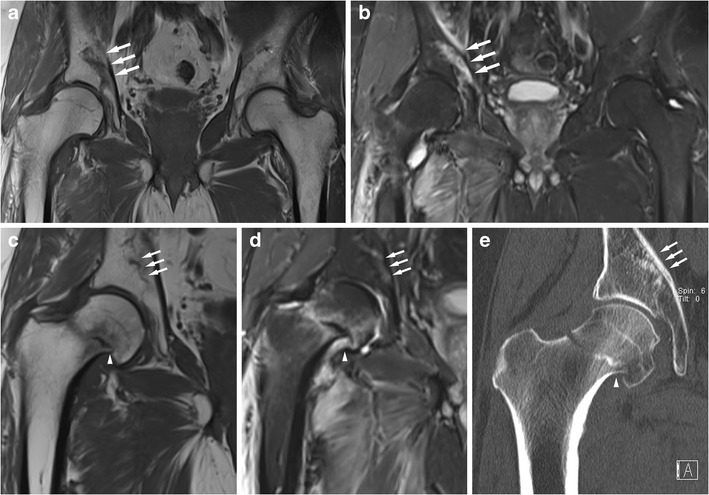 Fig. 9