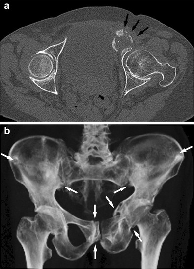 Fig. 10