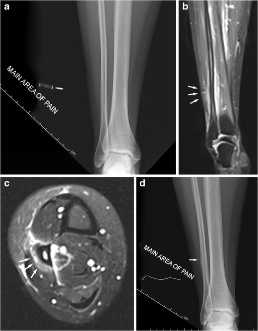 Fig. 11