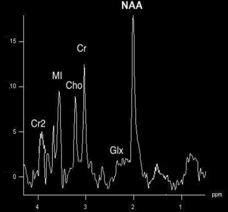 Fig. 2