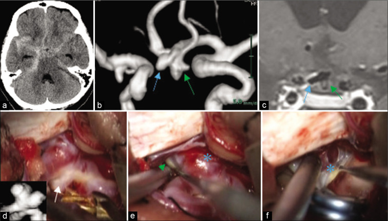 Figure 2: