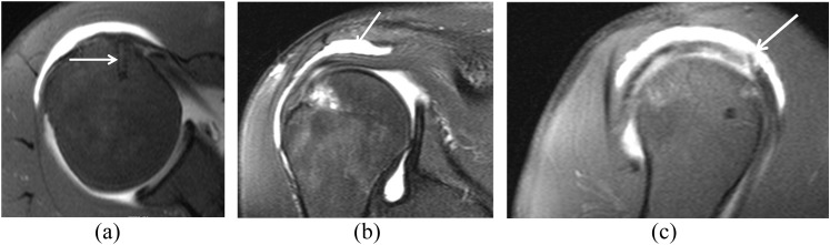 Figure 11.