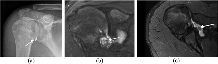 Figure 13.