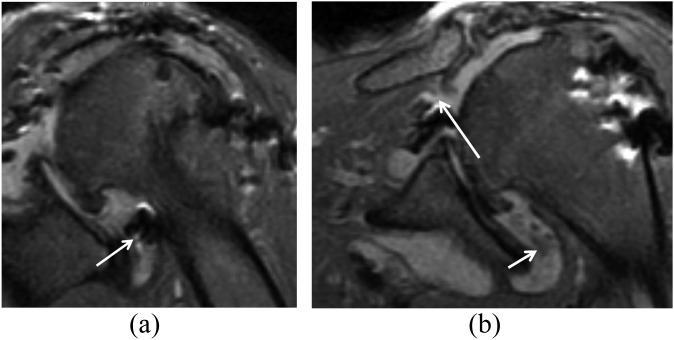 Figure 14.