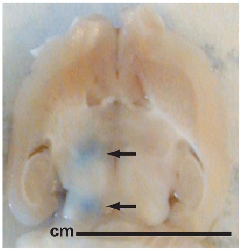 Fig. 3