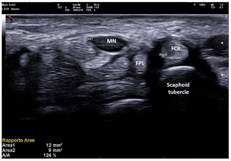 Figure 5