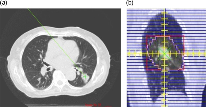 Fig. 11.
