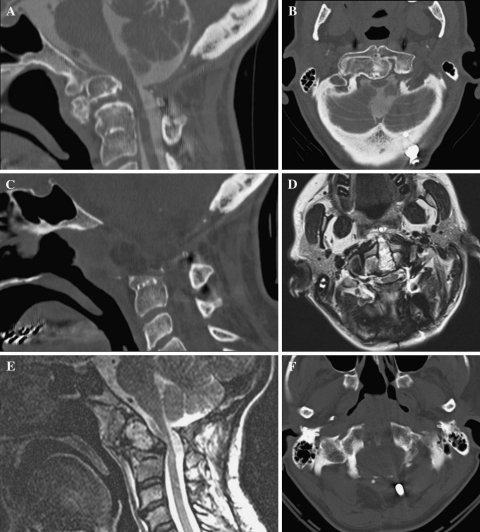 Fig. 3