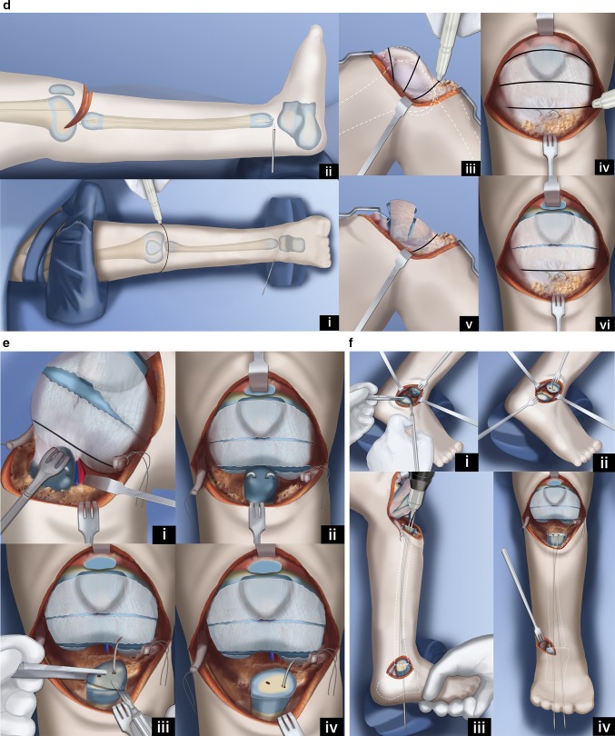 Fig. 12