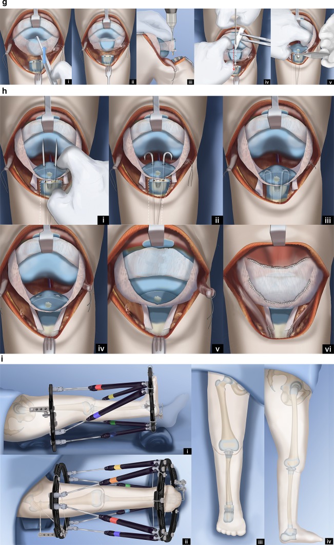 Fig. 12