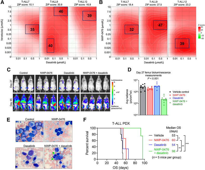 Figure 5. Combination of BH3 mimetics and TKIs synergize in T-ALL. A, ZIP synergy plots of T-ALL primary cells treated with venetoclax and dasatinib. B, ZIP synergy plots of T-ALL primary cells treated with NWP-0476 and dasatinib. C, Bioluminescence imaging of NSG mice engrafted with luciferase-expressing T-ALL PDX cells. D, Bar graphs showing average bioluminescence measurements from femurs of mice on day 27. E, Blood smears of mice in different treatment groups, obtained on day 45. Arrows indicate blasts undergoing apoptosis. F, Kaplan–Meier OS curves of mice engrafted with T-ALL PDX cells and treated with vehicle control, oral NWP-0476, oral dasatinib, and oral NWP-0476 plus dasatinib combination (*, P < 0.05; **, P < 0.01; ***, P < 0.001).