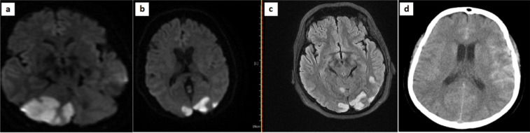 Figure1