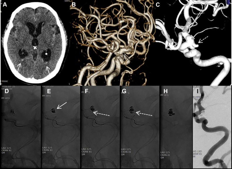 Fig. 1