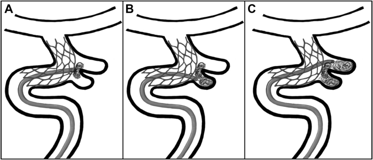 Fig. 2