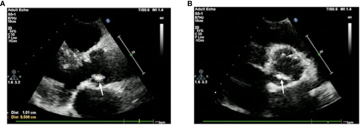 Figure 3