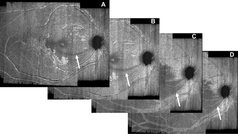 FIGURE 3