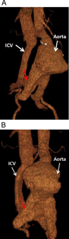 Fig 3: