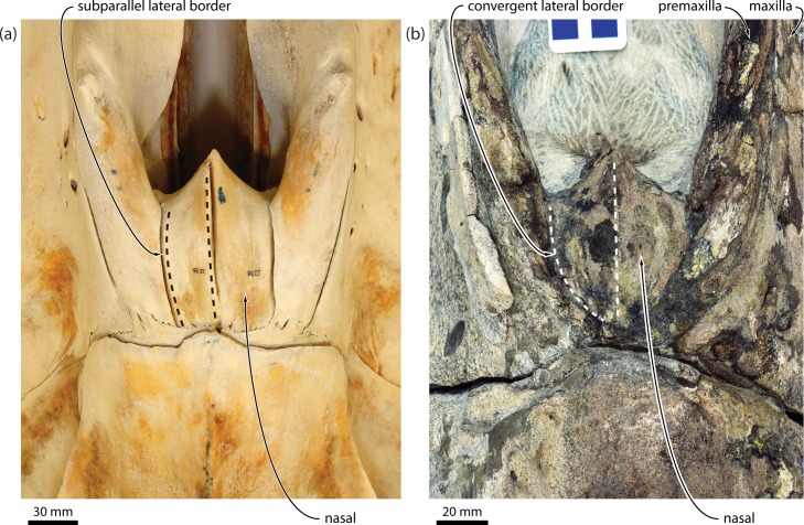 Fig 14