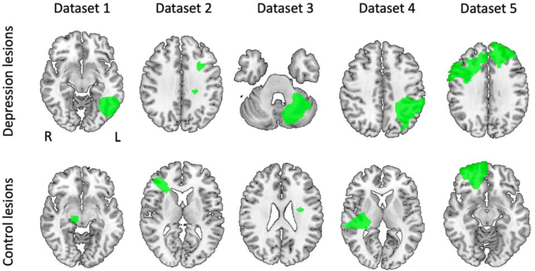 Figure 1: