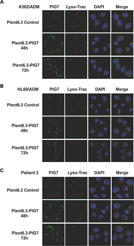 Figure 11