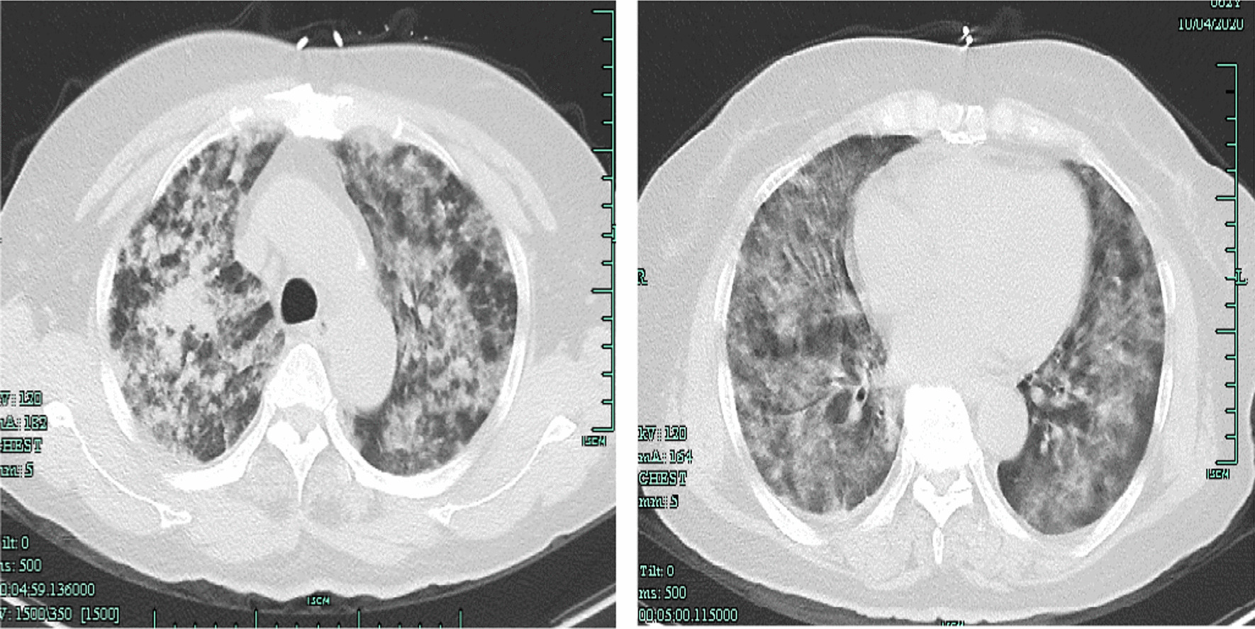 Fig. 1