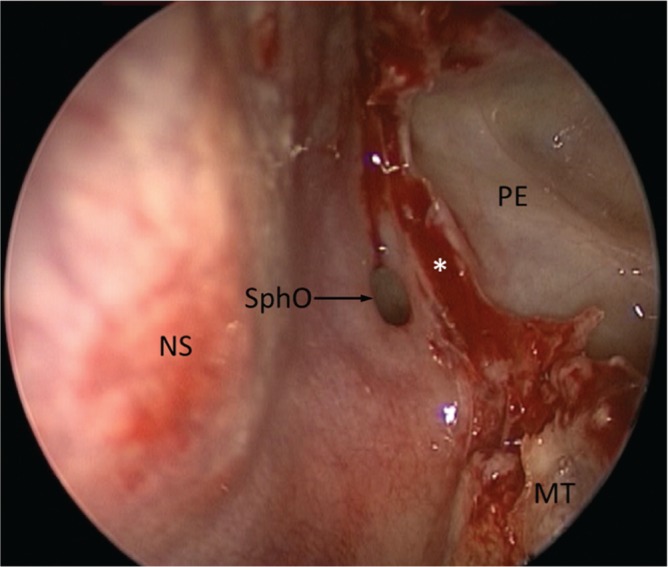 Fig. 3.