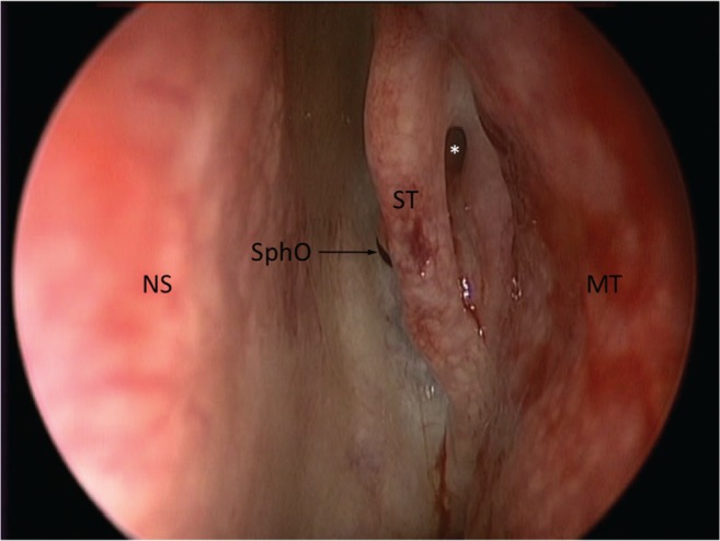 Fig. 1.